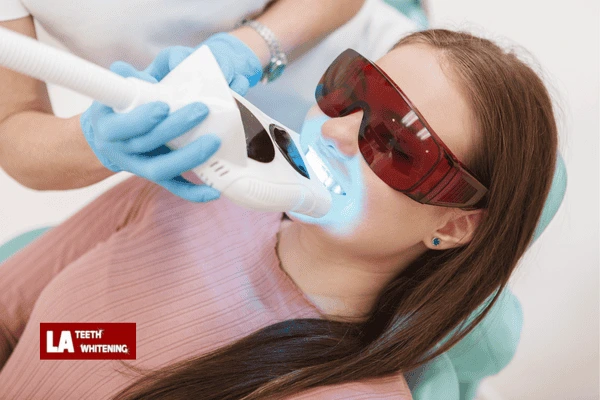 Do You Get Instant Hollywood-White Teeth After One Session Seaford